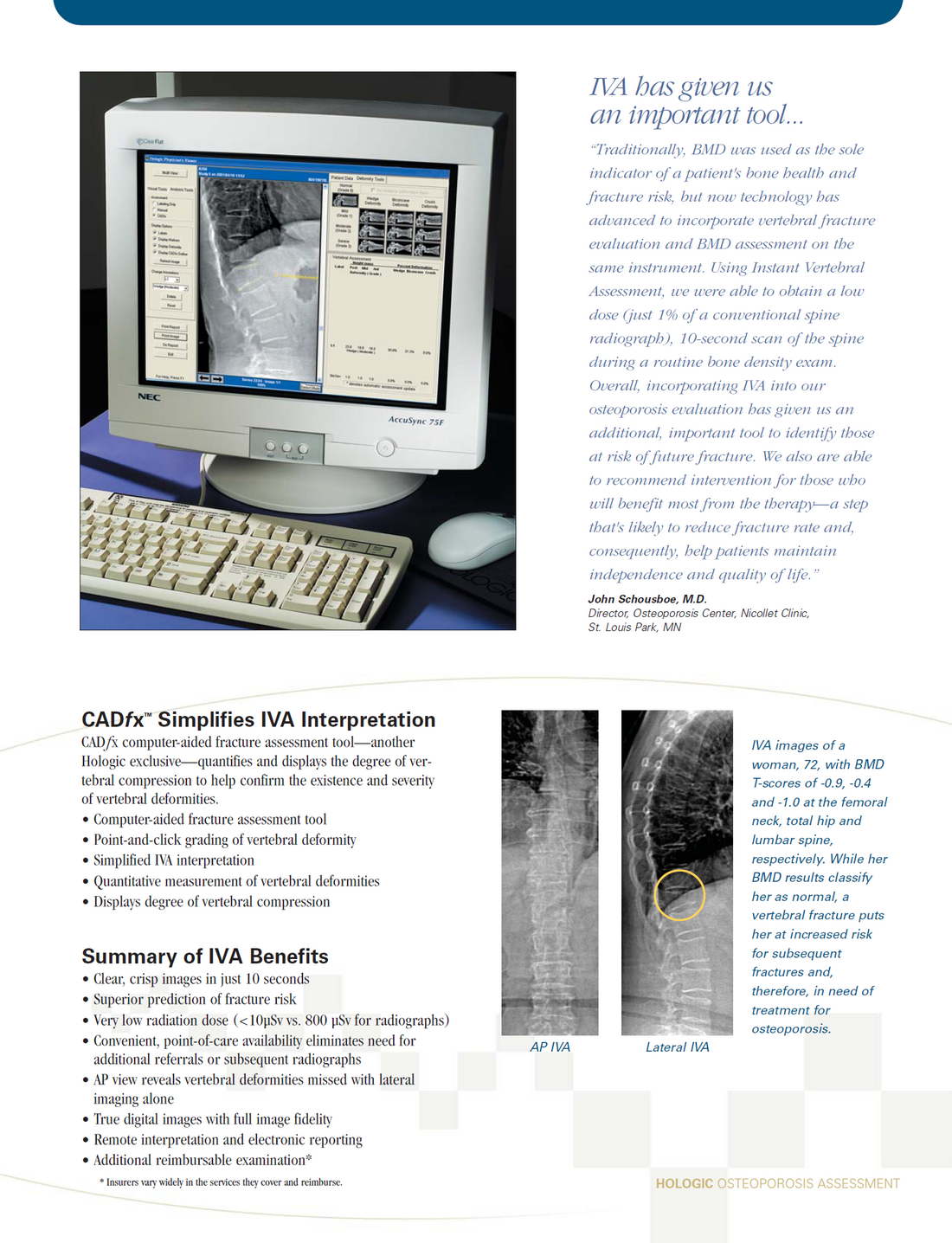 Hologic Discovery QDR Series Bone Densitometer – Medical Equipment Doctor